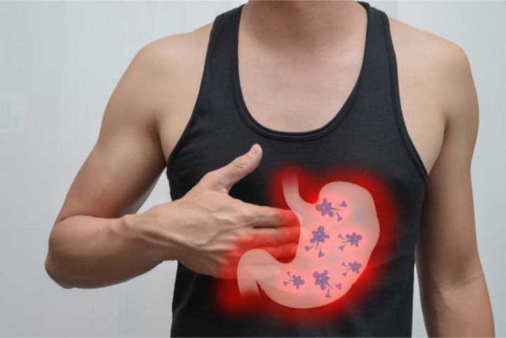 Cứu người đàn ông mắc cùng lúc hai bệnh ung thư - 1