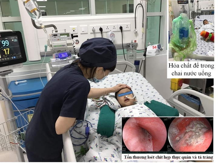 Cứu sống bé trai 3 tuổi ở miền Tây uống nhầm hoá chất - 1