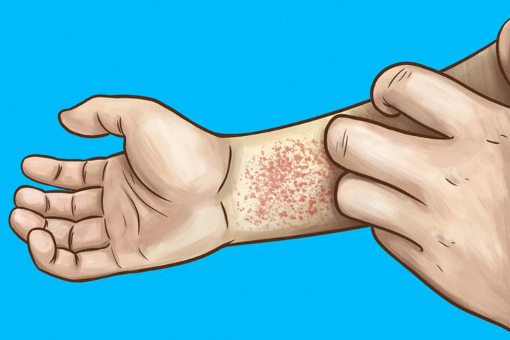 Những dấu hiệu cho thấy thận của bạn đang có vấn đề - 3