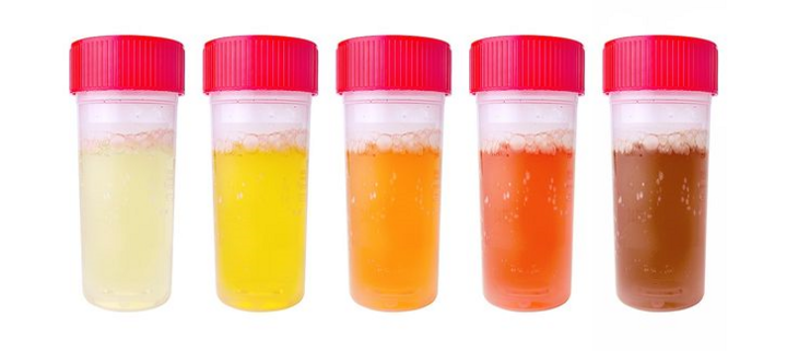 Những dấu hiệu cho thấy thận của bạn đang có vấn đề - 10