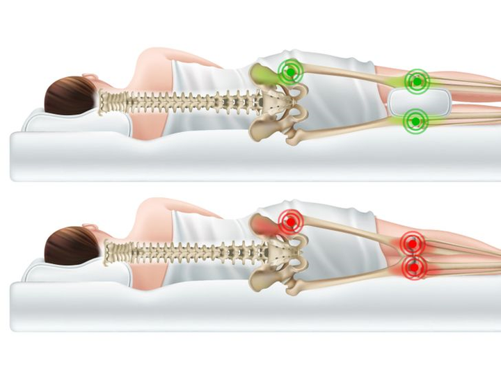 Tại sao bạn nên kẹp gối ở giữa hai chân khi ngủ? - 3