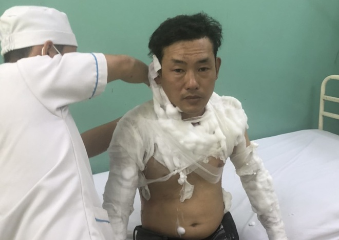 Danh tính nghi phạm mang xăng đi cướp ngân hàng ở TP.HCM - 1