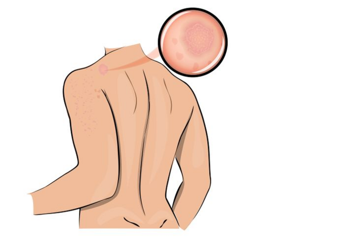 Dấu hiệu cảnh báo bạn đang quá căng thẳng - 1