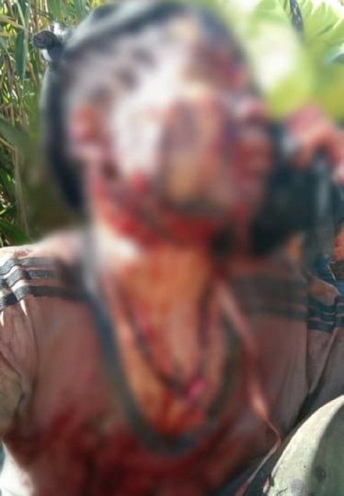 Bị gấu rừng tấn công, người đàn ông ở Quảng Nam nguy kịch - 1