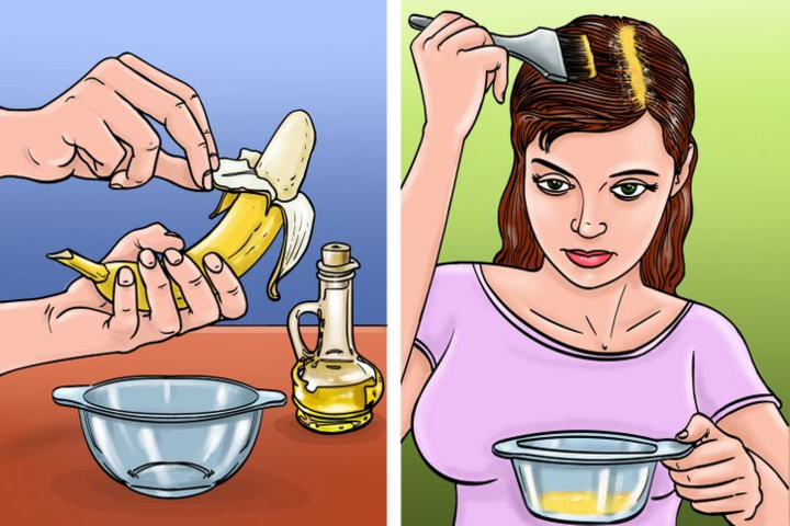 9 cách trị gàu cực tốt mà không cần dùng hóa chất - 3