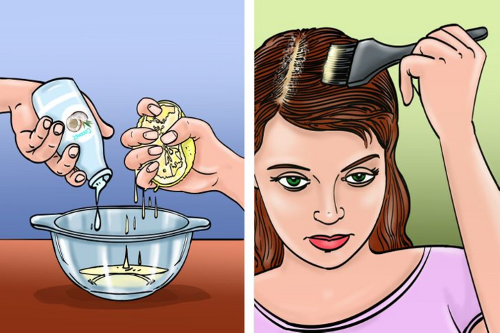 9 cách trị gàu cực tốt mà không cần dùng hóa chất - 5