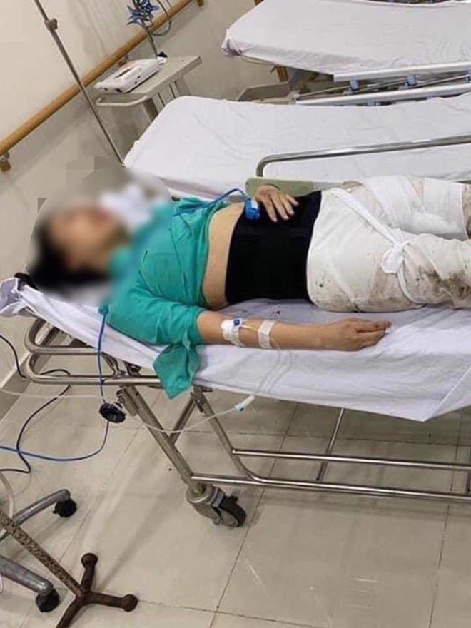 Lời cầu cứu của nữ tiếp viên hàng không bị tài xế Mercedes nghiện ma túy tông - 3