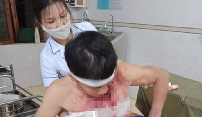 4 kẻ lạ mặt xông vào tấn công chủ nhà trọng thương - 1