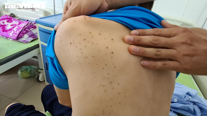 Chủ quán bánh xèo tra tấn cậu bé dã man có thể bị xử lý thế nào? - 2