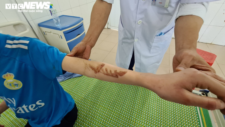 Chủ quán bánh xèo tra tấn cậu bé dã man có thể bị xử lý thế nào? - 3