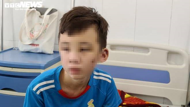 Chủ quán bánh xèo tra tấn bé trai dã man: Tỉnh Bắc Ninh chỉ đạo xử lý nghiêm - 1