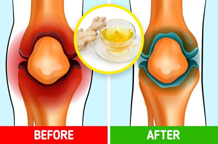 Cơ thể thay đổi thế nào nếu bạn uống trà gừng mỗi ngày? - 3