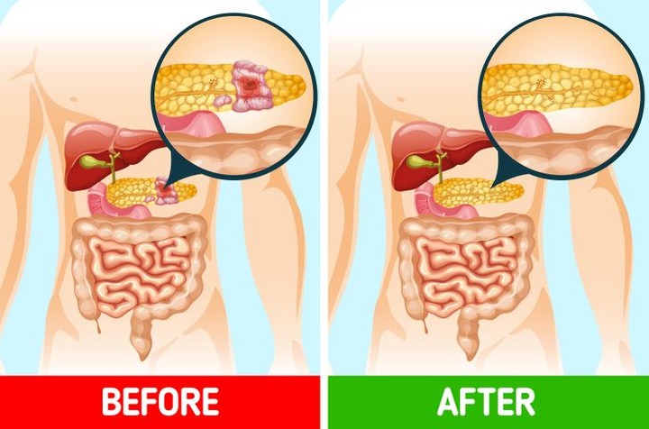 Cơ thể thay đổi thế nào nếu bạn uống trà gừng mỗi ngày? - 5