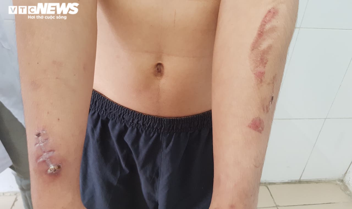 Bị chủ quán bánh xèo tra tấn dã man, vì sao nhân viên không bỏ trốn? - 2