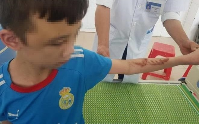 Nữ chủ quán bánh xèo tra tấn nhân viên như thời trung cổ lĩnh 30 tháng tù giam - 2