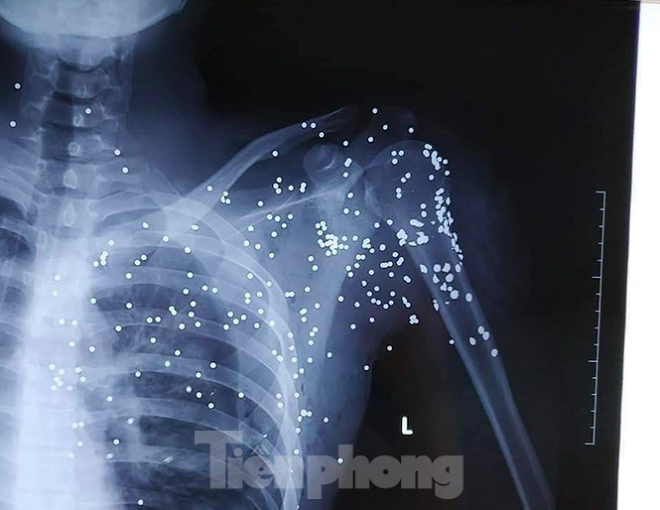 Lộ nguyên nhân vụ nã súng như phim 'xã hội đen' ở Thái Bình - 3