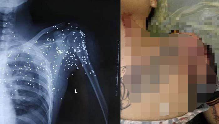 Kẻ nã súng như phim 'xã hội đen' vào nam thanh niên ở Thái Bình ra đầu thú - 1