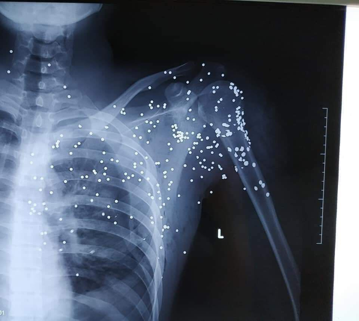 Khởi tố kẻ nã súng như phim 'xã hội đen' ở Thái Bình - 1