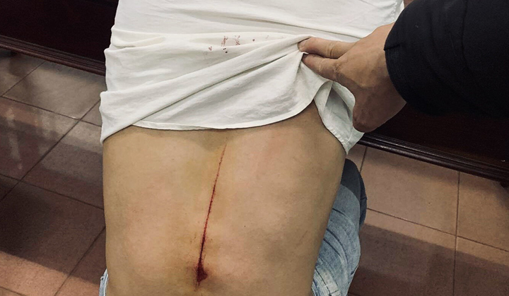 Truy tìm kẻ chém người đàn ông nghi do báo tin liên quan đến gỗ lậu - 1