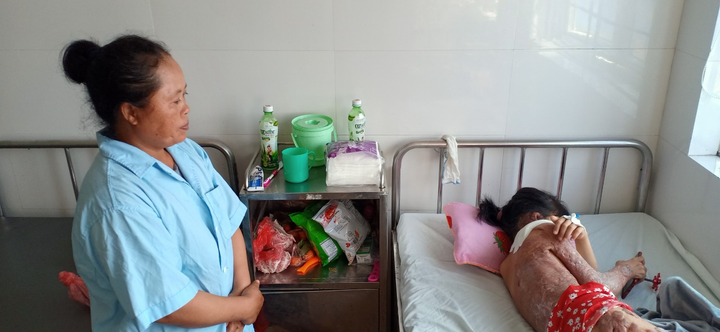 Xót xa bé 11 tuổi bị bỏng, cằm dính liền cổ, cánh tay dính chặt thân - 1