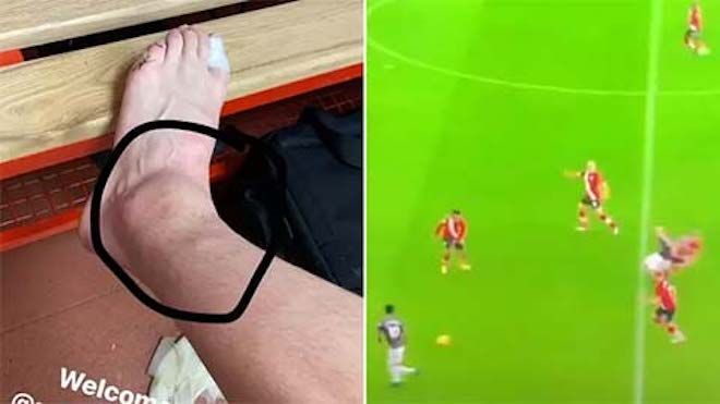 Van de Beek đăng ảnh gây sốc sau lần đầu đá chính cho Man Utd ở Ngoại hạng Anh - 1