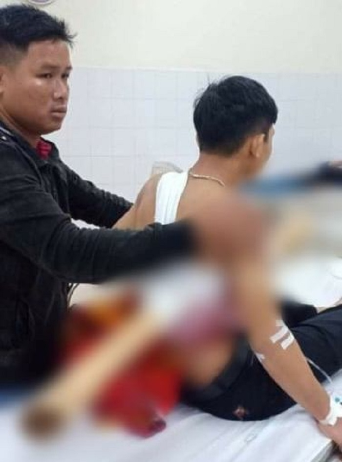 Sức khỏe của nam thanh niên bị khúc keo đâm xuyên người giờ ra sao? - 1