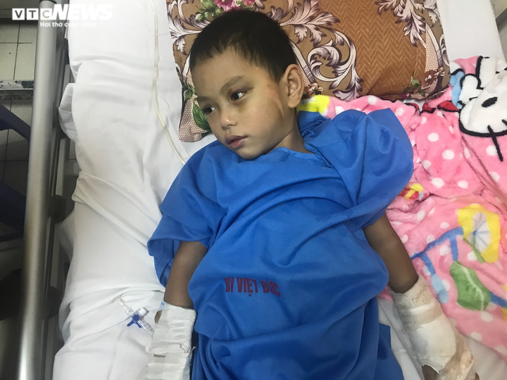 Hoàn cảnh cùng cực của người đàn ông bị vợ bỏ, con trai tai nạn nguy kịch - 2