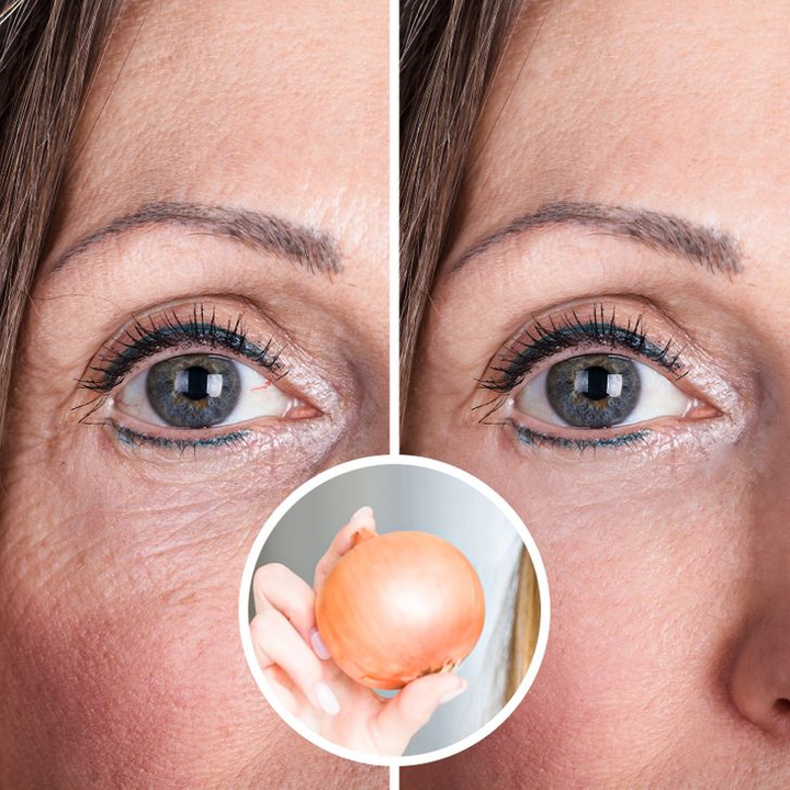 Điều gì xảy ra với cơ thể khi bạn ăn hành tây mỗi ngày? - 7