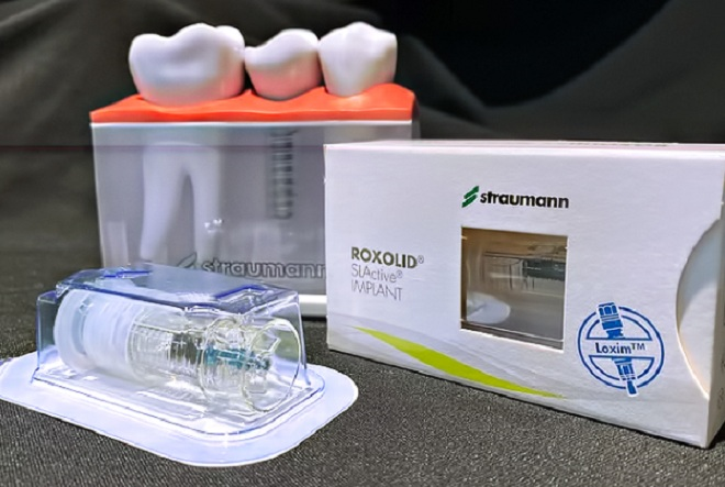 Trồng răng Implant All on 4, All on 6 có tốt? - 2