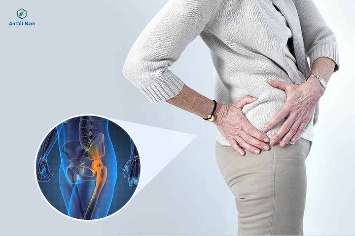 Bác sĩ Nguyễn Bá Vưỡng chia sẻ về chứng đau từ thắt lưng xuống mông - 1