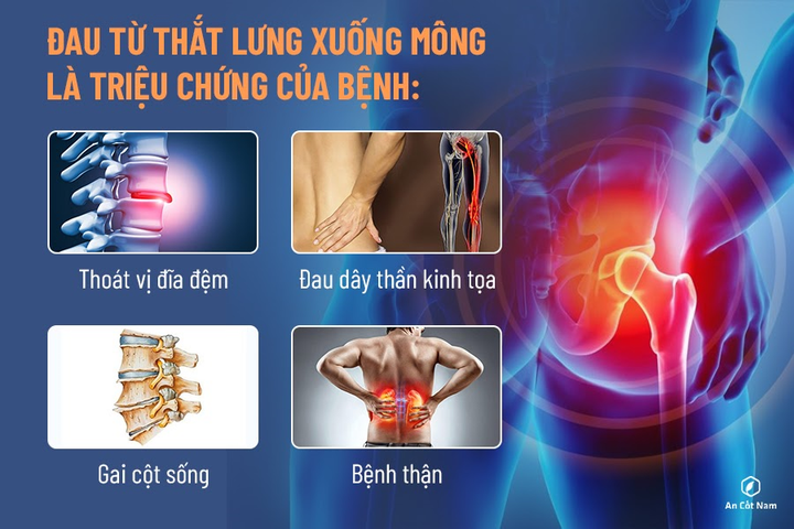 Bác sĩ Nguyễn Bá Vưỡng chia sẻ về chứng đau từ thắt lưng xuống mông - 2