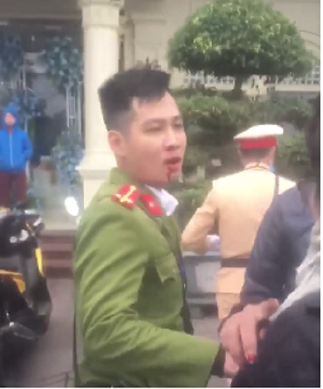 Tài xế xe máy ở Hải Phòng lăng mạ, đấm chảy máu một trung úy công an - 1