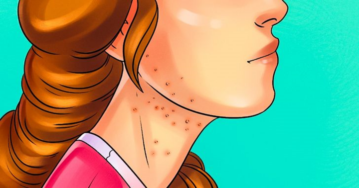 Ăn quá nhiều đường, cơ thể sẽ ra sao? - 4