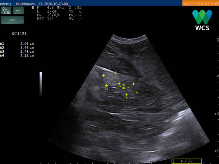 Tìm thấy hậu duệ của rùa Hoàn Kiếm ở hồ Đồng Mô - 3