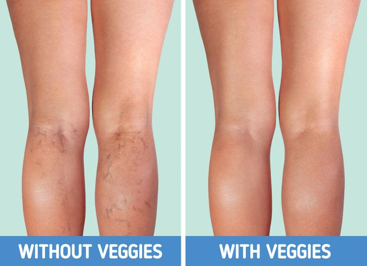 Điều gì xảy ra với cơ thể khi bạn ngừng ăn trái cây và rau xanh? - 6