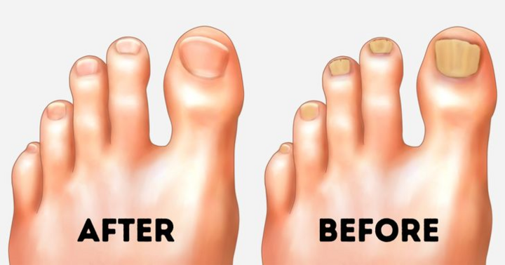 Mẹo hay giúp đôi bàn chân luôn nuột nà, hoàn hảo bất chấp giá rét - 1