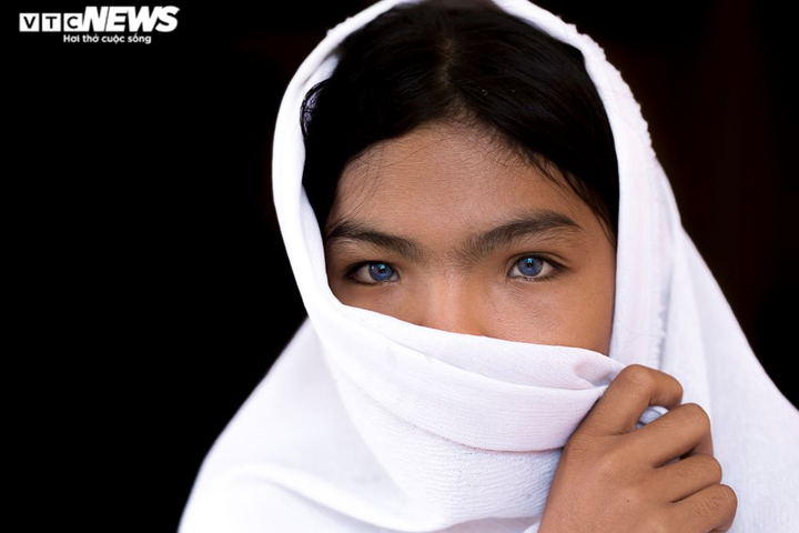 Ảnh: Đôi mắt hai màu kỳ lạ của cô gái người Chăm ở Ninh Thuận - 8