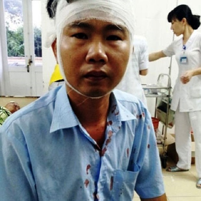 Lý lịch bất hảo của tài xế xe 'dù' đánh nam thanh niên chảy máu mũi ở Hà Tĩnh - 3