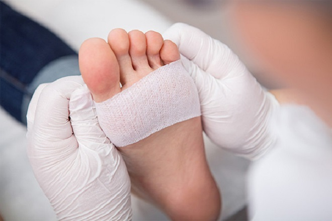 Biểu hiện ở bàn chân cảnh báo bệnh tiểu đường - 1