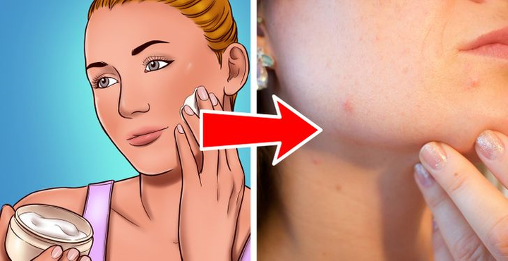 8 sai lầm khi chăm sóc da khiến lỗ chân lông ngày càng to - 5