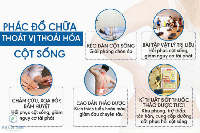 Những điều cần biết về bệnh thoái hóa cột sống - 5
