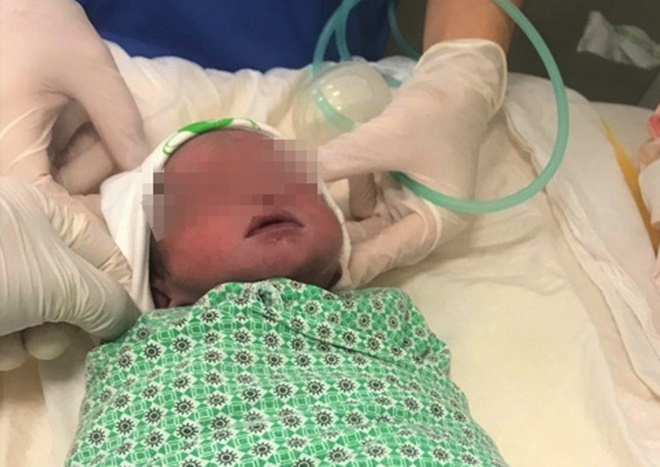 Bé trai sống sót kỳ diệu khi thai song sinh còn lại bị sảy trước đó 2 tháng - 1