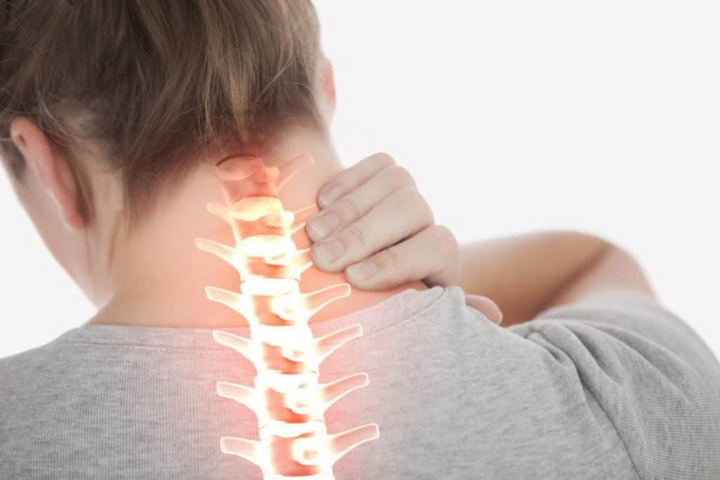 Dấu hiệu thoát vị đĩa đệm cổ và cách chữa - 1