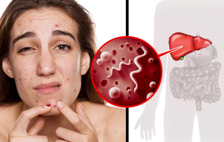 Dấu hiệu cảnh báo cơ thể bạn đang chứa đầy chất độc - 10