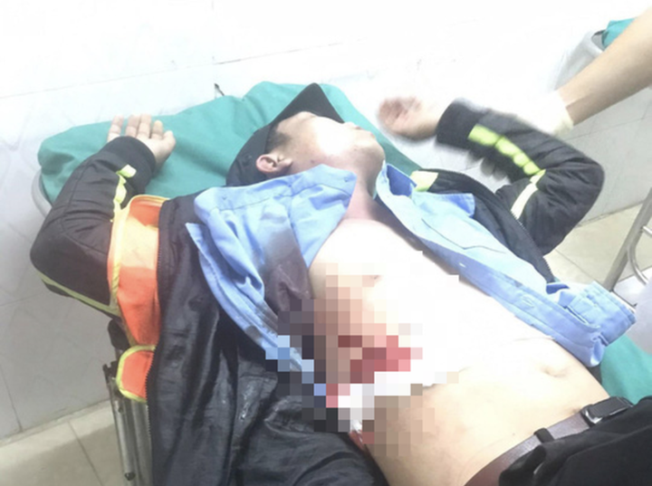 Khởi tố kẻ đâm nhân viên Trạm thu phí BOT Ninh Xuân ở Khánh Hòa - 1