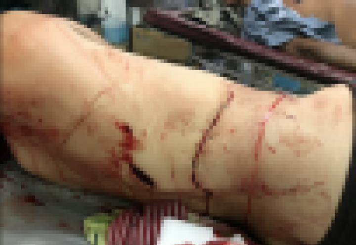 Gã đàn ông chém con riêng của vợ suýt chết vì thấy hai mẹ con ngủ chung giường - 2