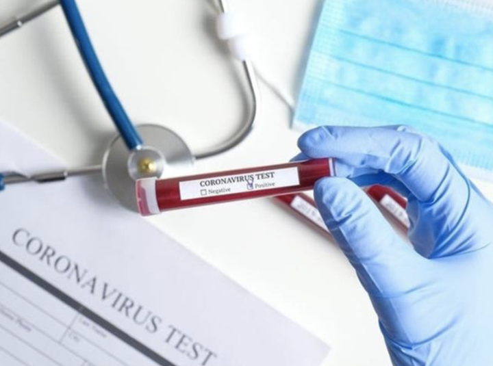 Hai mẹ con người Nga ở Vũng Tàu âm tính với SARS-CoV-2 - 1