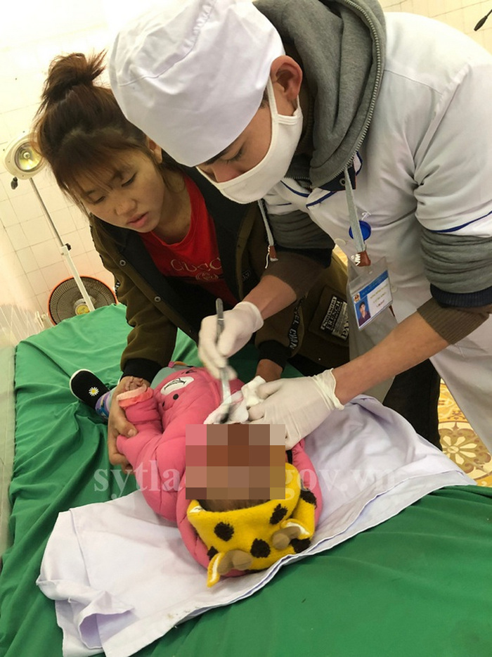 Bé 11 tháng tuổi ở Lào Cai ngã úp mặt vào đống than khi đang sưởi ấm - 1