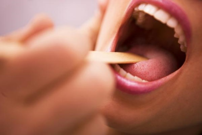 Dấu hiệu ở lưỡi cảnh báo bệnh ung thư - 1