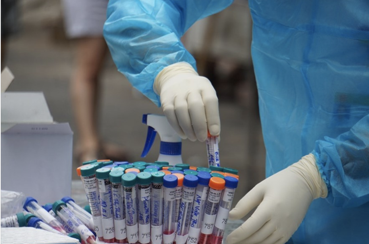 Xét nghiệm COVID-19 cho tất cả nhân viên Bệnh viện Mắt TP.HCM - 1